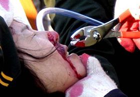 中国民主党反酷刑观察：中共酷刑：打牙、拔牙、撬牙、撞牙